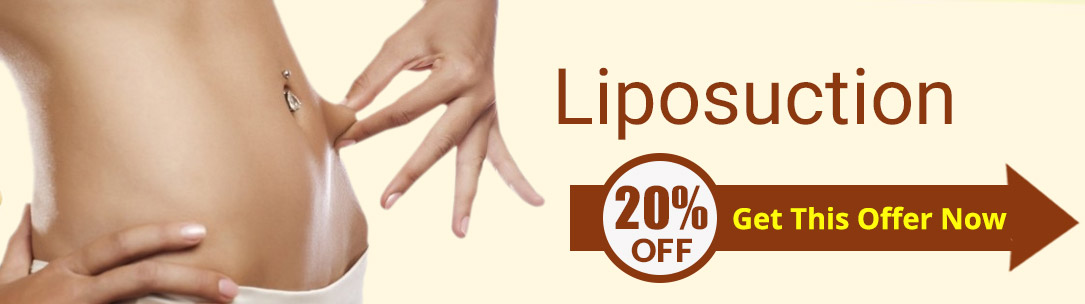 liposuction