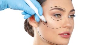 facelift surgery by dr arif