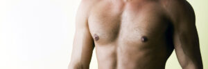 gynecomastia in men