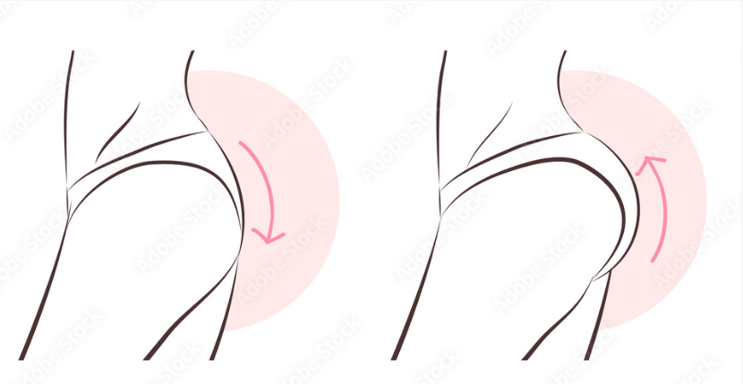 BBL Technique: It's All About the Shape 