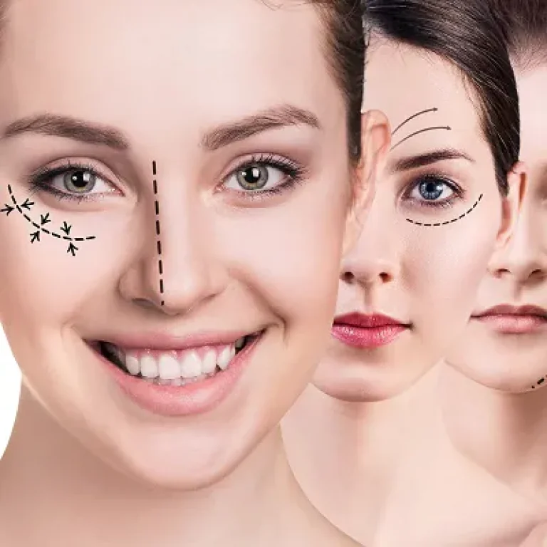 Before-and-After-Results-of-Cosmetic-Surgery-in-Islamabad