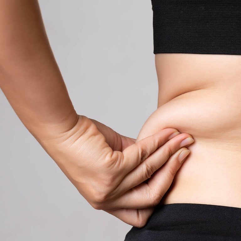Liposuction