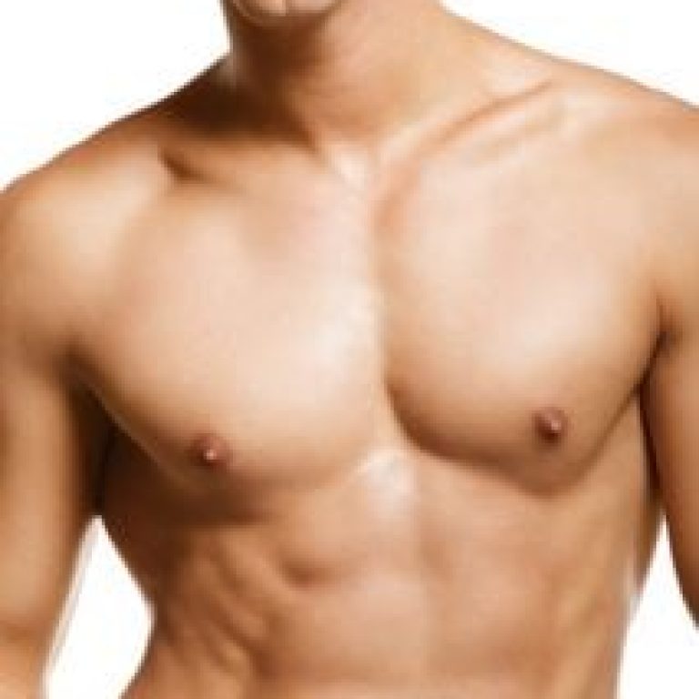 Male-chest-lipo-213x300