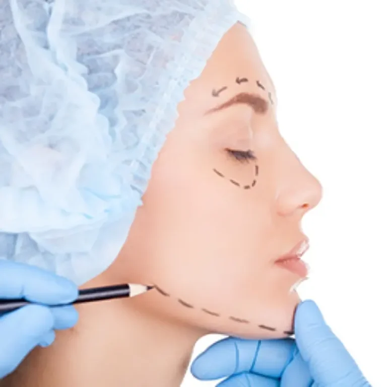 chin-neck-lipo