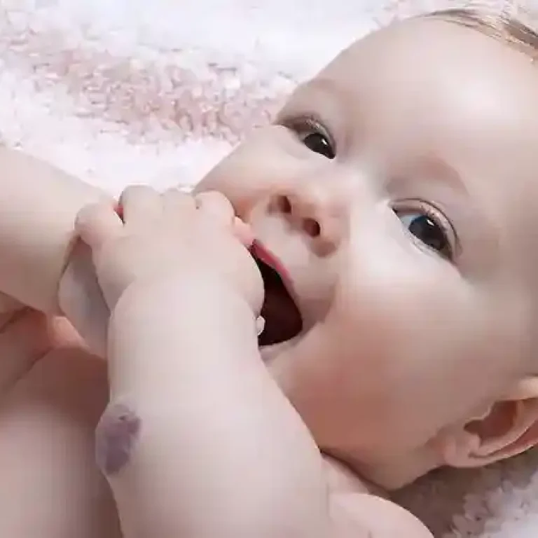 hemangioma