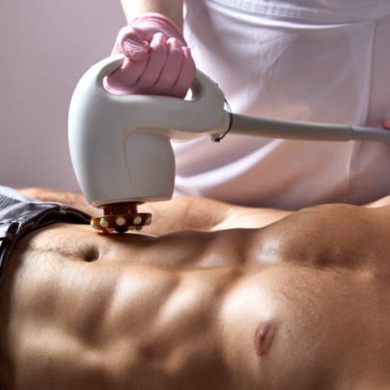 Man receiving fat reductive skin lifting body treatment on modern equipment at cosmetology clinic, male body care concept