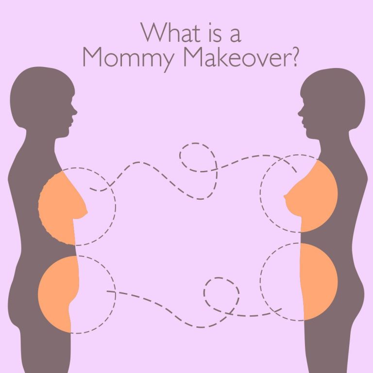 mommy makeover