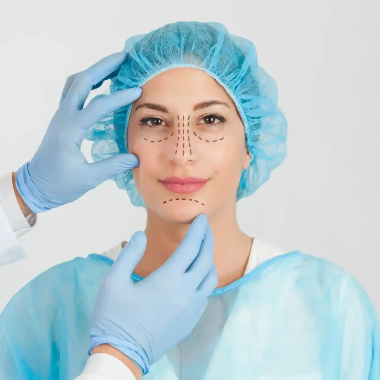 nose-reshaping